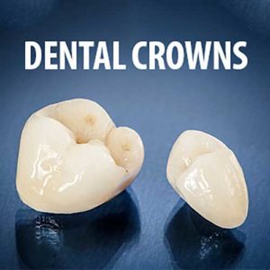 Dental Crowns
