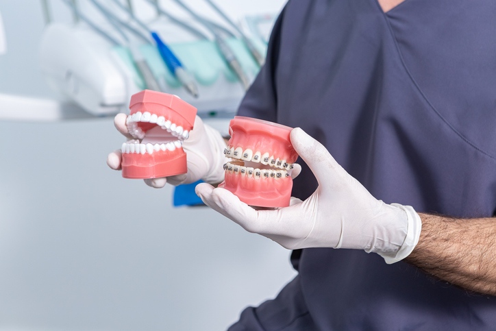 A dental professional holding models to compare implant and denture options in Highland, IN.